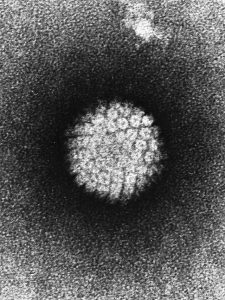 Papilloma_Virus_(HPV)_EM by Public domain in wikipedia