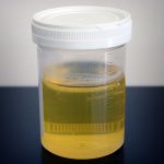 Urine sample By Turbotorque (Own work) [Public domain], via Wikimedia Commons
