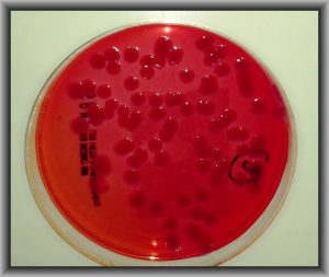 Escherichia coli by Iqbal Osman in Flikr CC BY 2.0