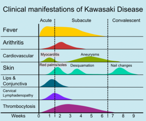 Kawasakidiseasemanifestations.png by Madhero88 in Wikipedia CC BY-SA 3.0
