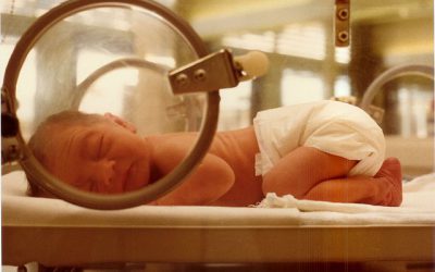 Análisis de la morbilidad ponderoestatural en recién nacidos pretérminos de muy bajo peso supervivientes a la enterocolitis necrotizante