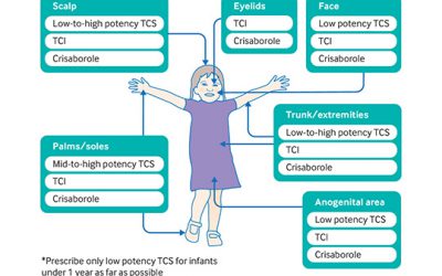 Dermatitis atópica: cuando los corticoides tópicos “no funcionan”