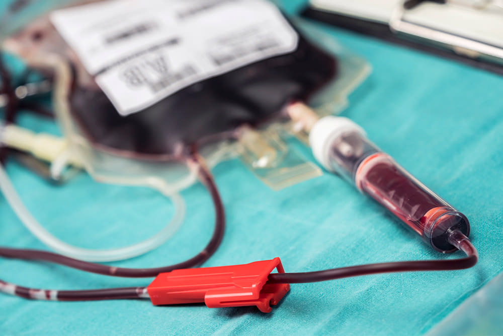 Recomendaciones sobre transfusión de plasma y plaquetas en niños críticos